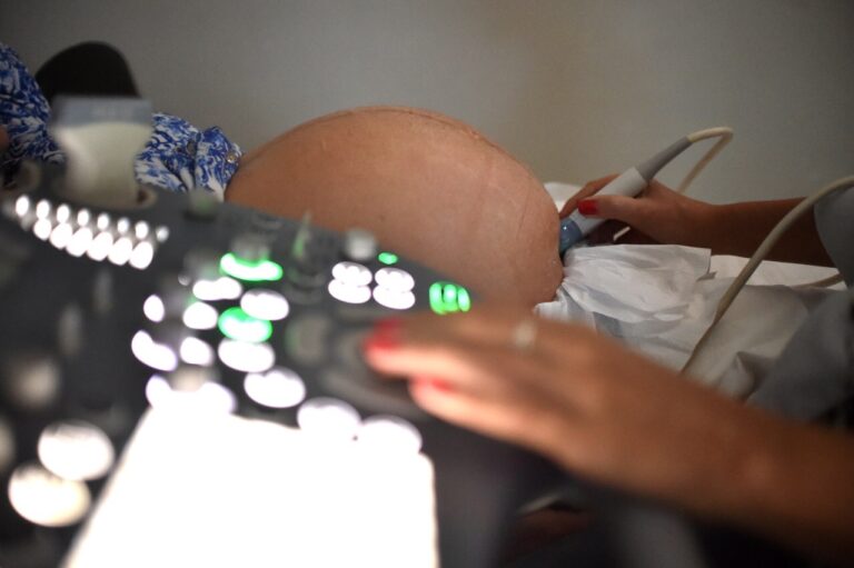 Convênio GDF Saúde reduz em 240 dias carência para partos