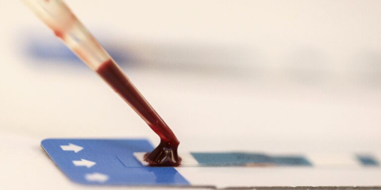 Estudo inédito da Fiocruz pode ampliar prevenção de HIV entre jovens