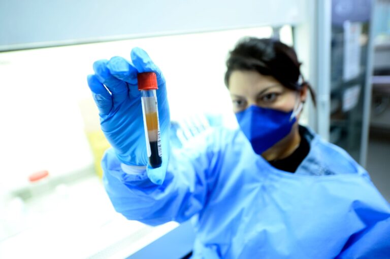 Novos exames reforçam resposta da saúde pública em casos graves no DF